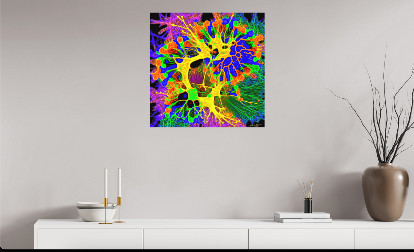 Neuroplasticity